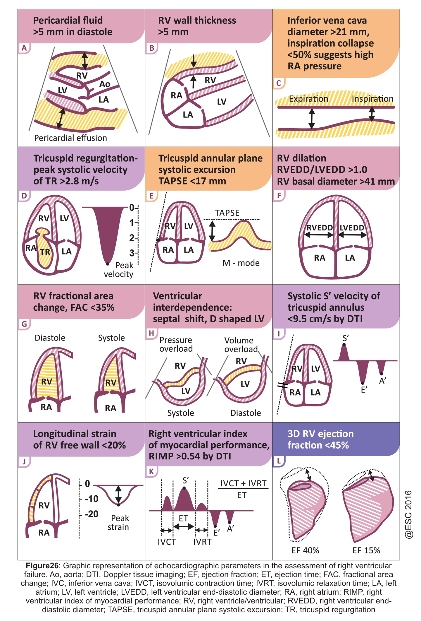 echocardiographic assessment of the right heart schematic illustration