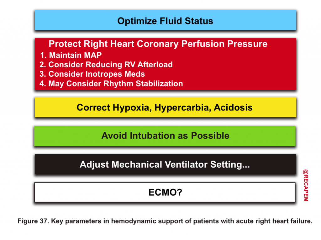 Right Ventricular Failure