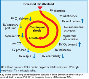 Acute Right Heart Failure: Principles of Diagnosis and Management In The ED  Revisited.