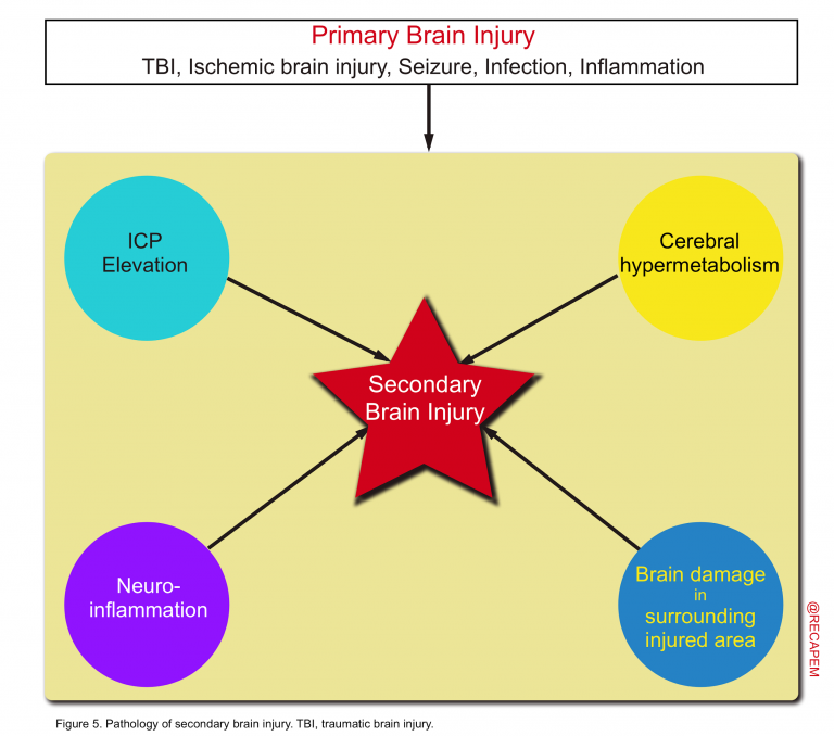 Secondary Brain Injury “Time is the Brain” RECAPEM