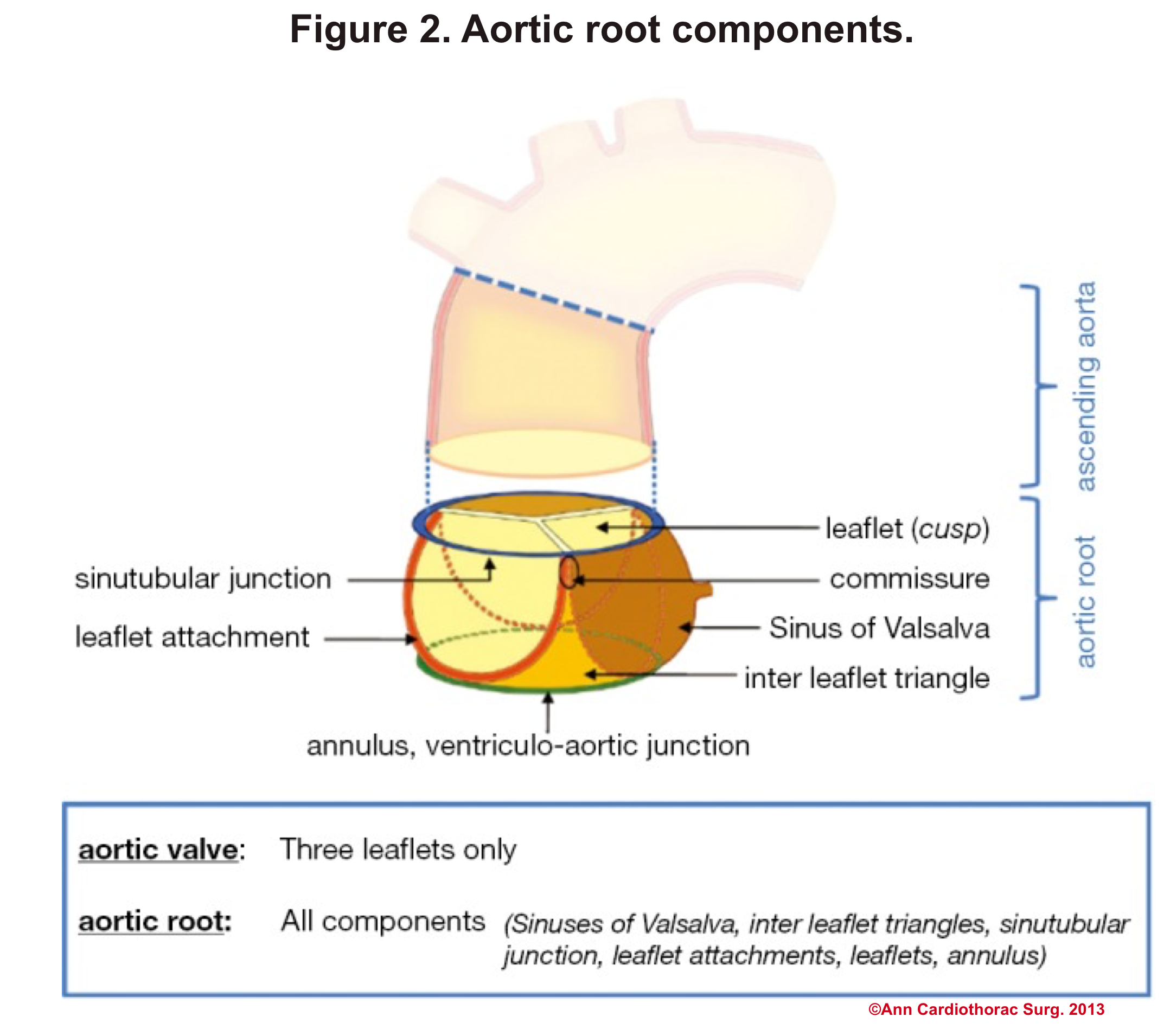 aortic root components