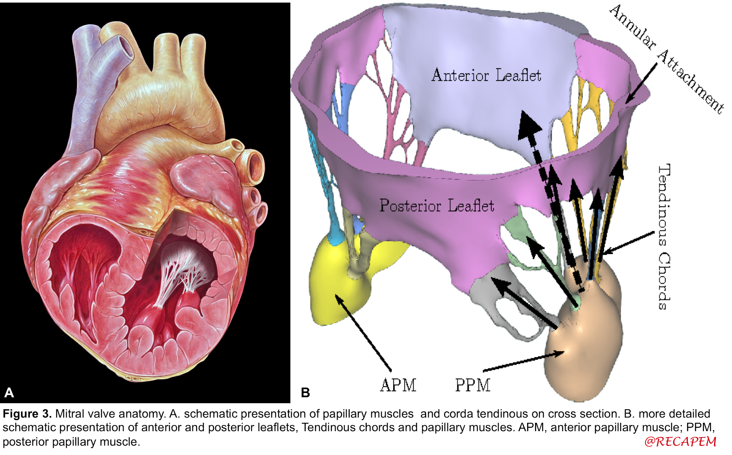 papillary muscle blood supply