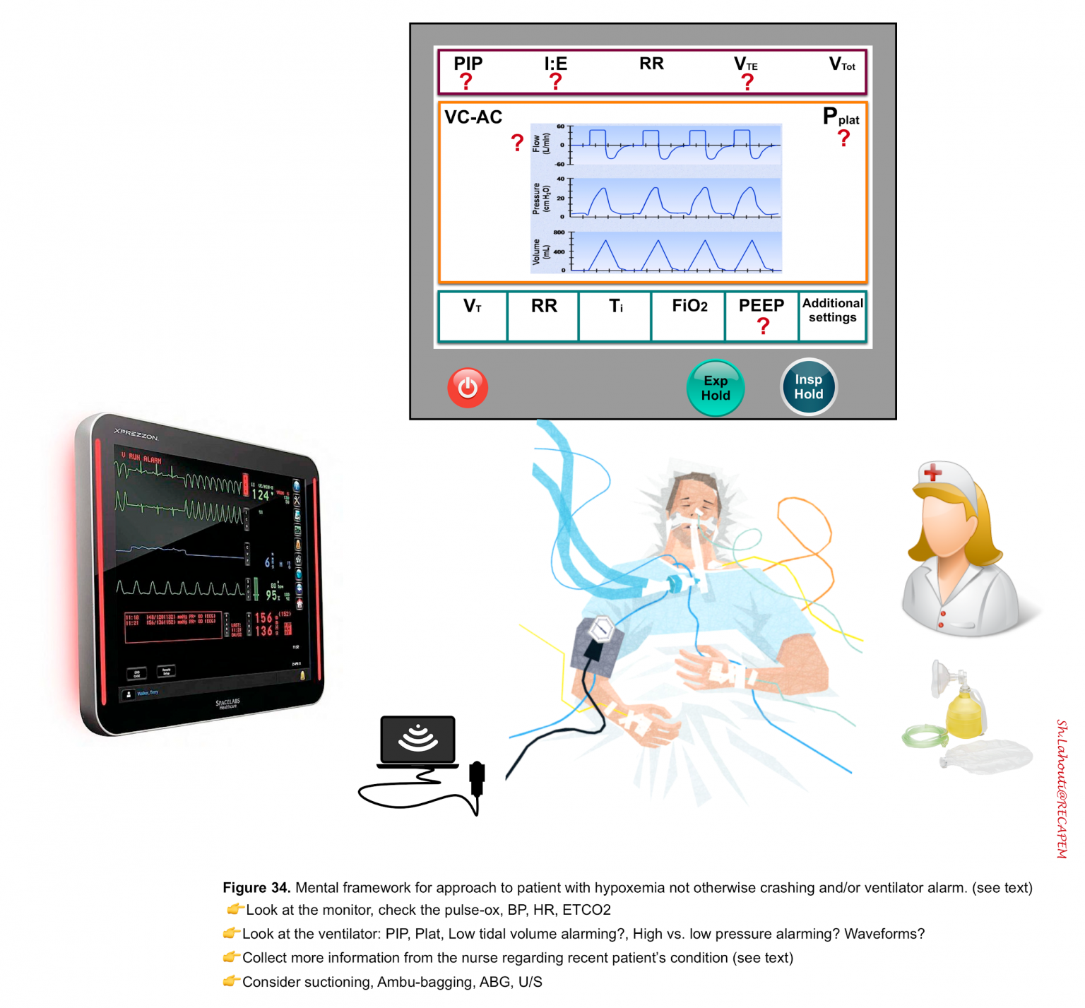Mechanical Ventilation From Bench to The Bedside Review RECAPEM