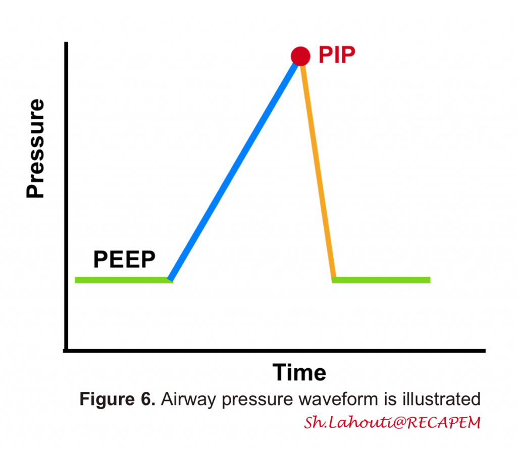 pip in mechanical ventilation