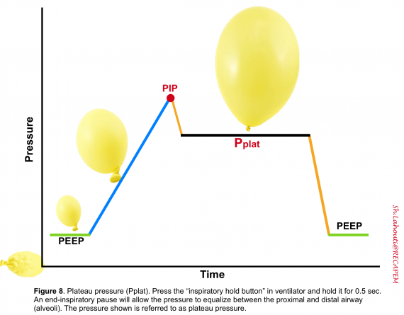 pip in mechanical ventilation pip in mechanical ventilation