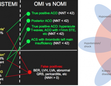 Acute Myocardial Infarction: A shifting paradigm
