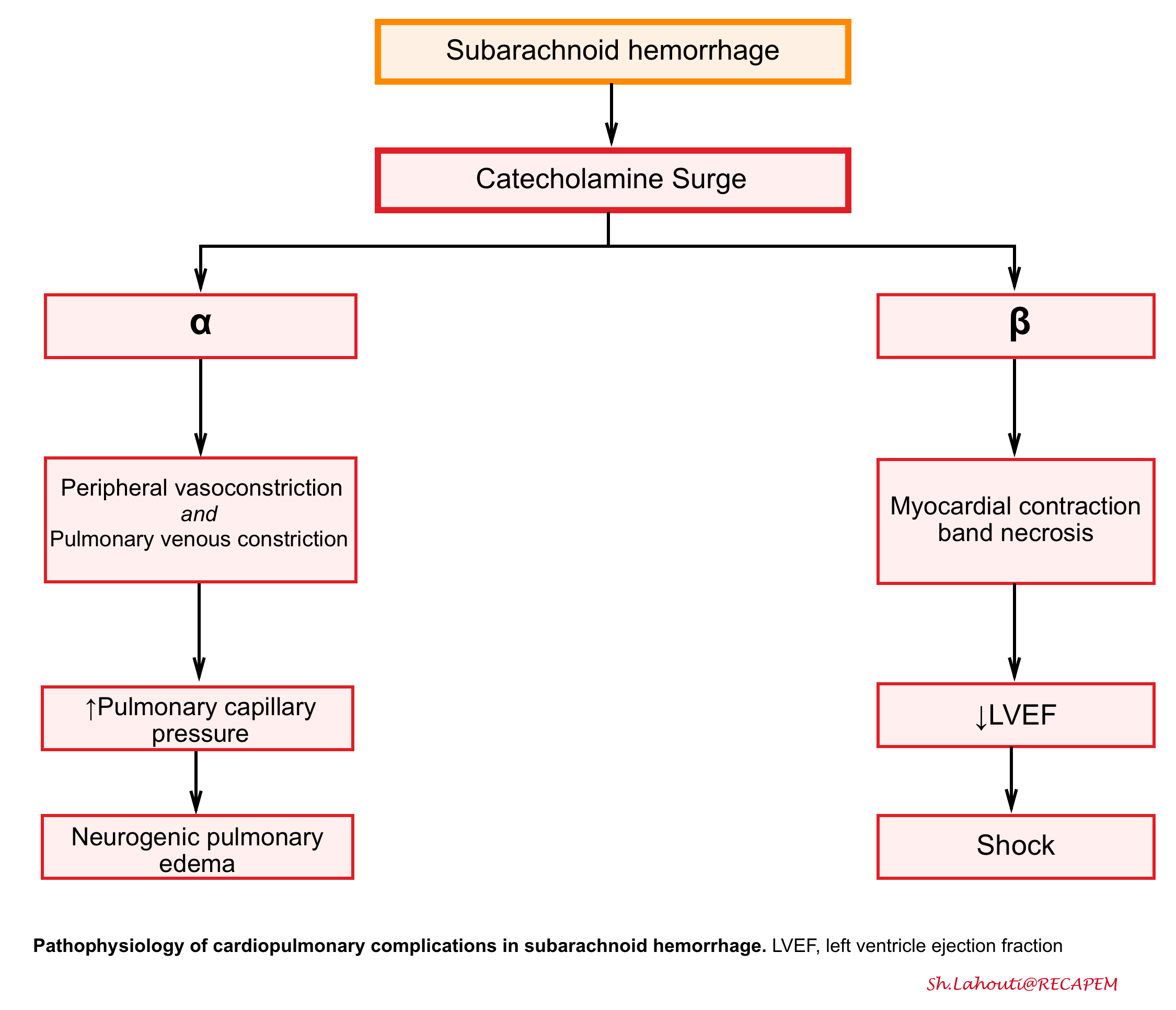 Subarachnoid Hemorrhage (SAH): Symptoms & Treatment