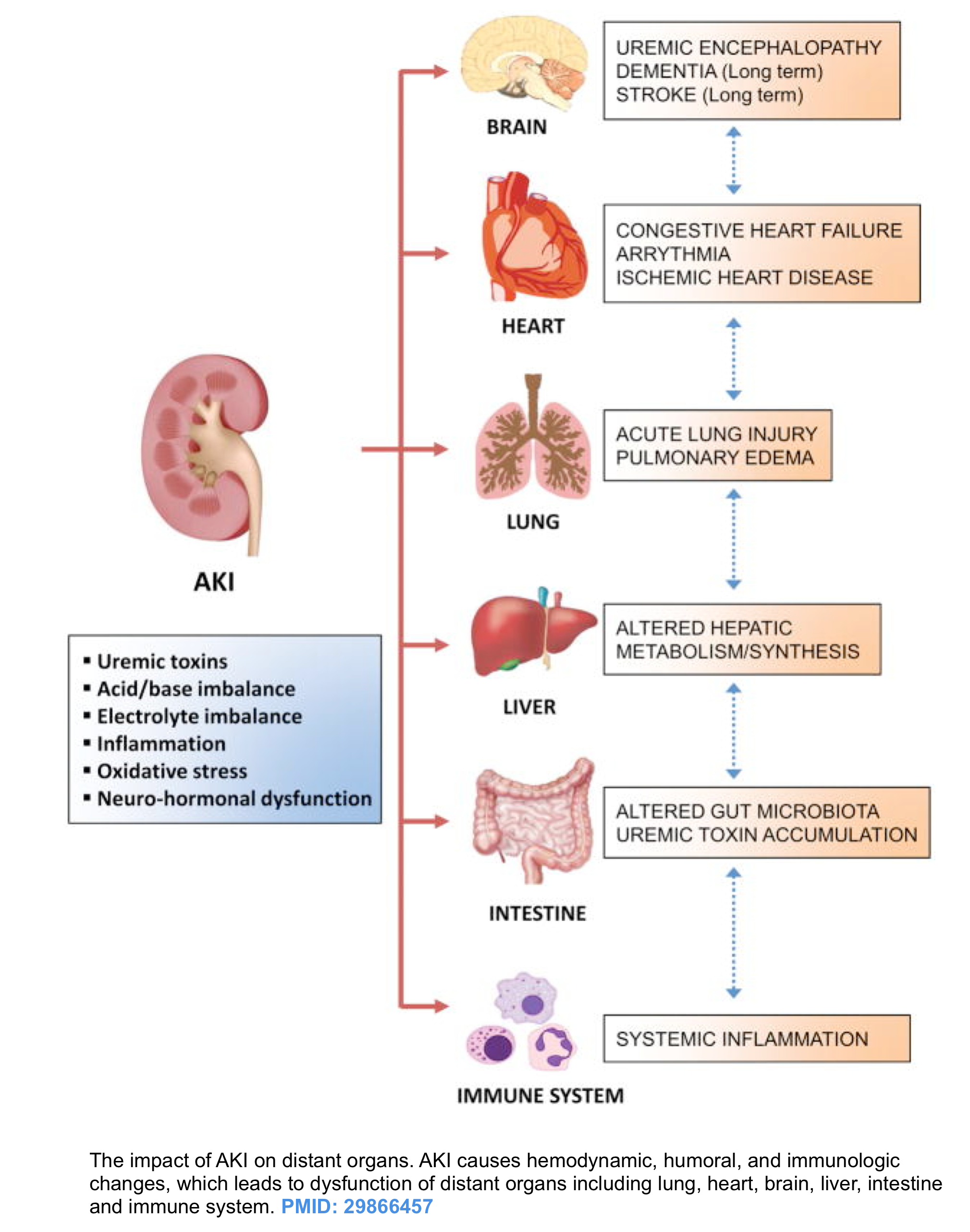 Acute Kidney Injury Principles Of Diagnosis And Renoresuscitation In