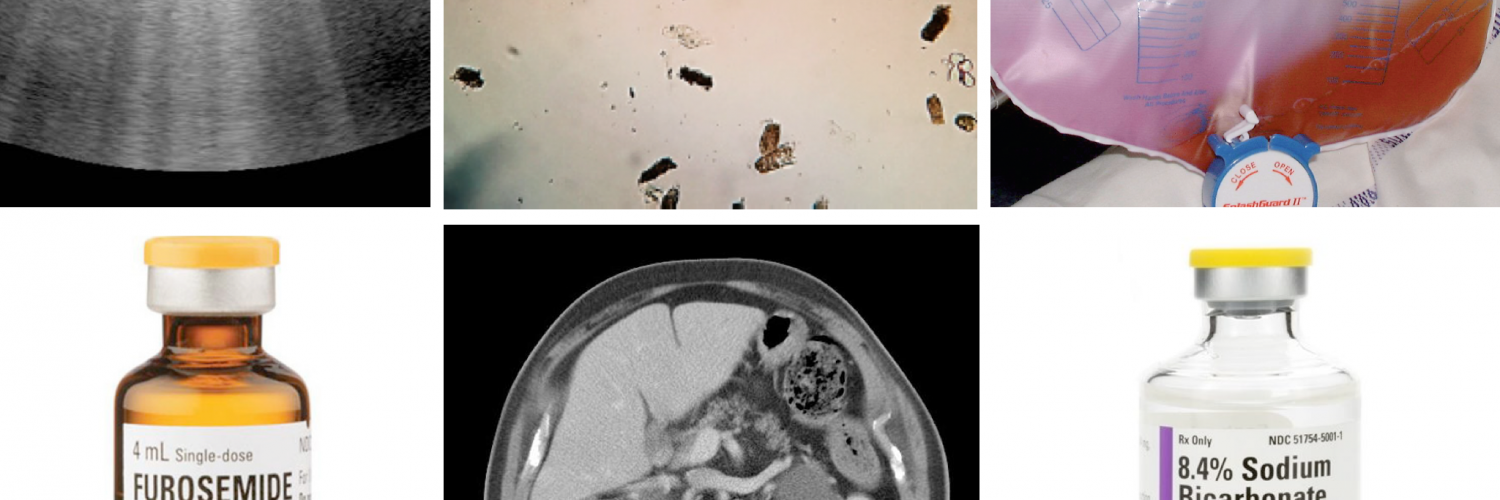 Acute renal failure