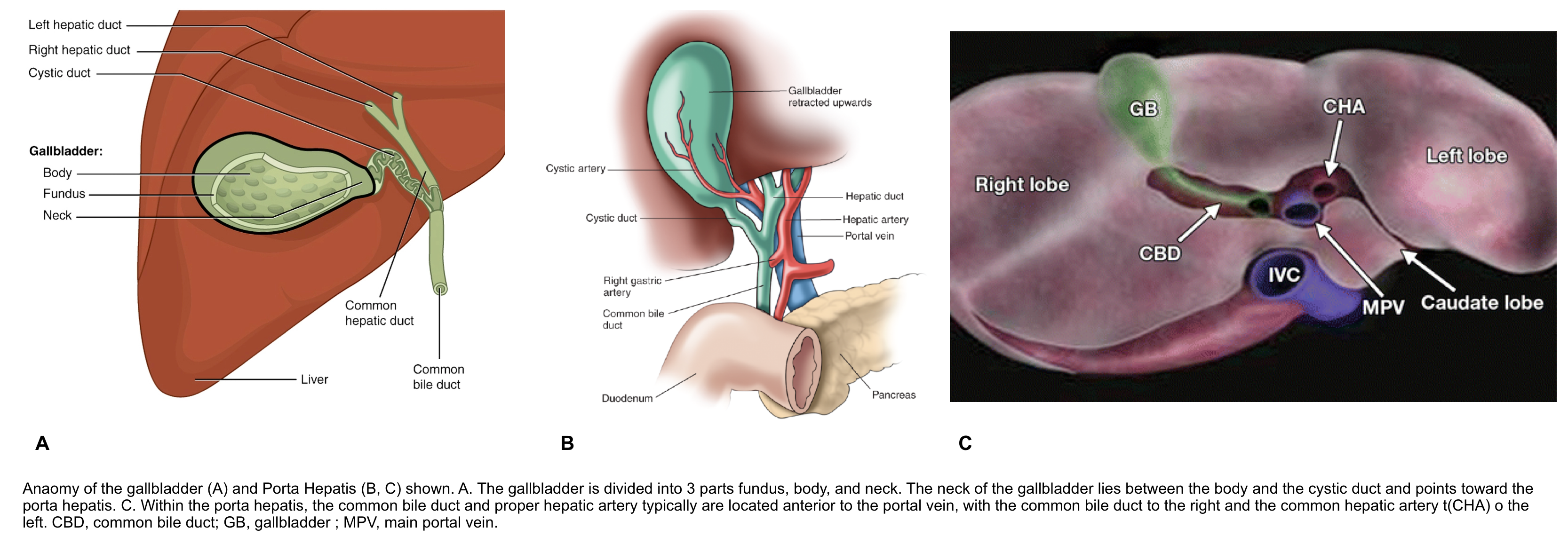 bile duct dilation symptoms