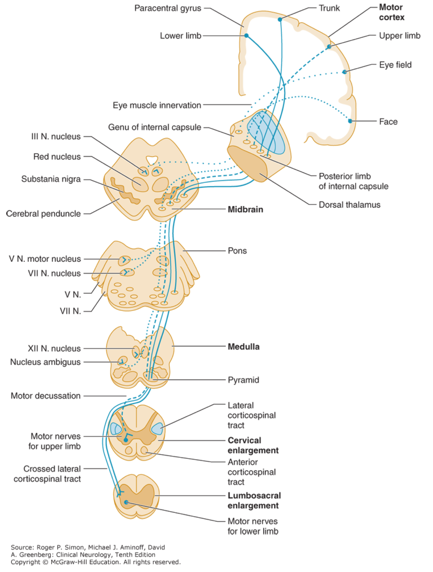 Neuromuscular Weakness RECAPEM