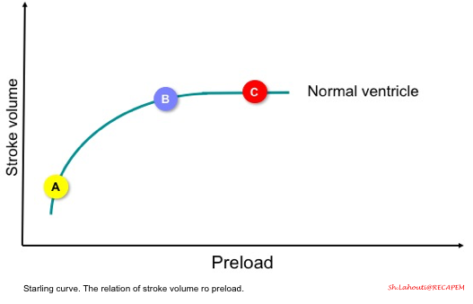 Acute Right Heart Failure: Principles of Diagnosis and Management In The ED  Revisited.