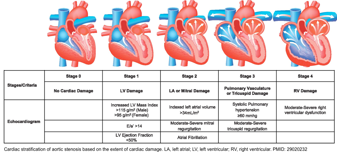 pathophysiology of aortic stenosis
