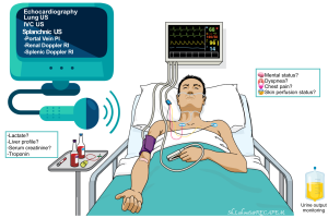 Critical care echocardiography