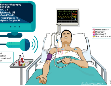 Critical care echocardiography