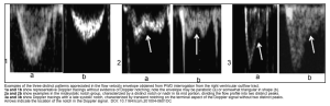 echocardiography in contemporary hemodynamic monitoring