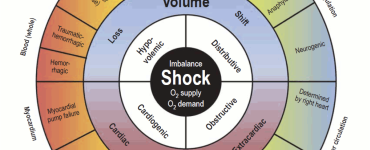 shock in emergency department