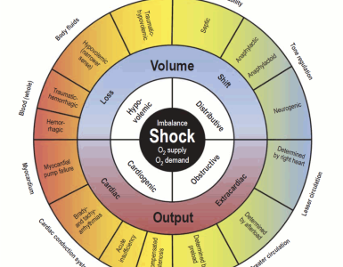 shock in emergency department