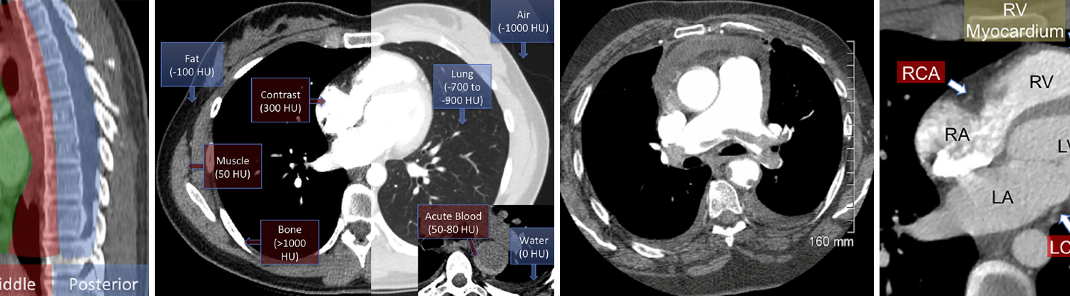 A Practical Guide to Read Chest CT For Emergency and Critical Care Physicians
