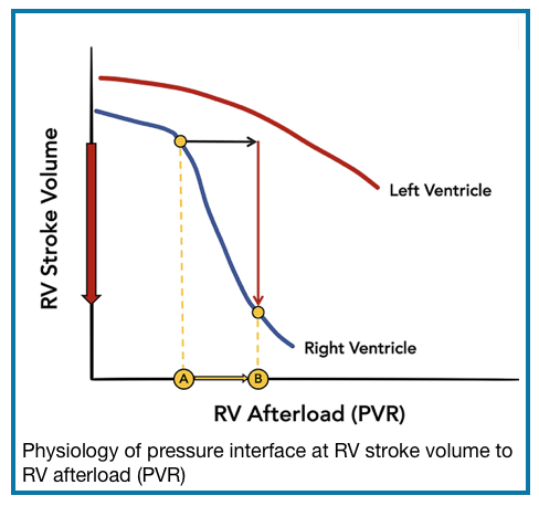 hemodynamic assessment or right ventricle